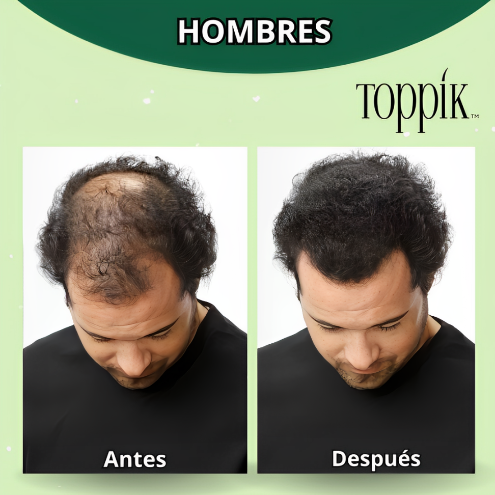 KIT TOPPIK 27.5GR + APLICADOR + PEINE (ÚLTIMAS UNIDADES)