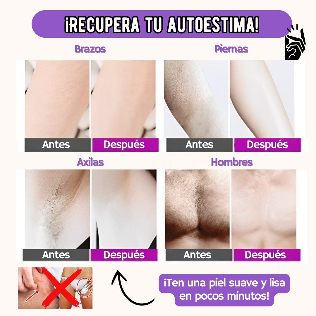 DEPILADORA YES PRO - OFERTA LIMITADA: 50%OFF + REGALO 🤩