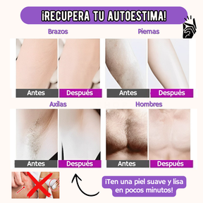 DEPILADORA YES PRO - OFERTA LIMITADA: 50%OFF + REGALO 🤩